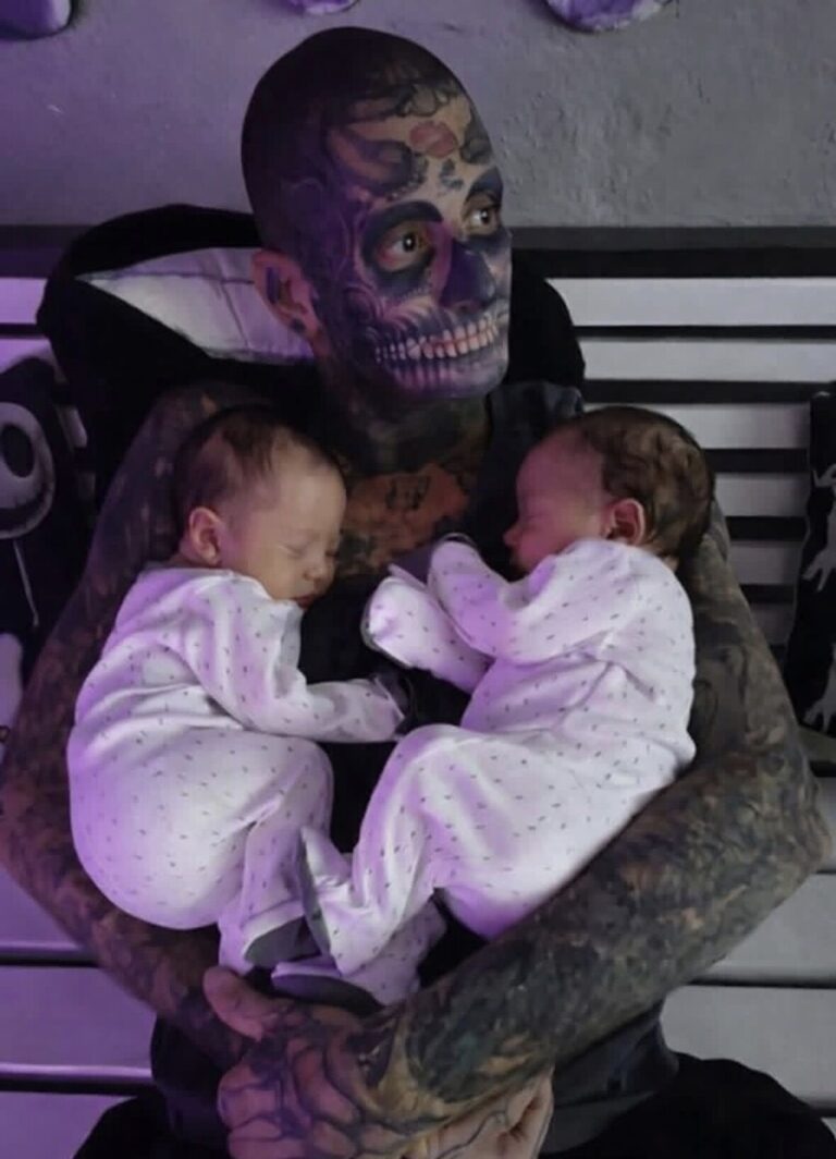 People call him a ‘monster’ and children think he is ‘scary.