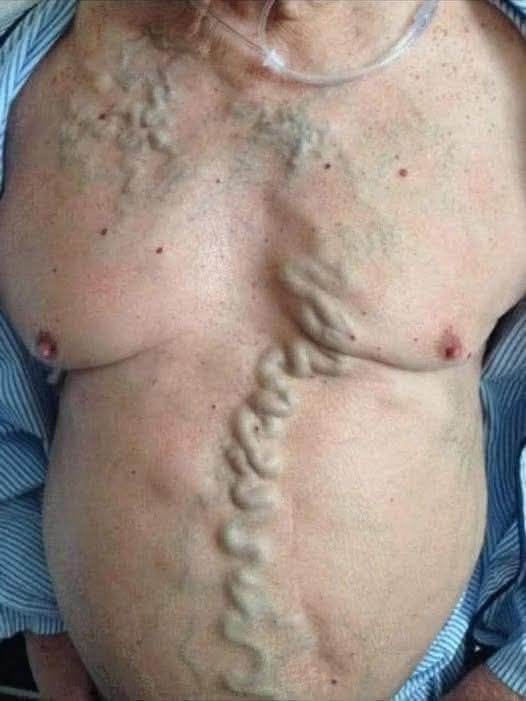 These are the consequences of sleeping with the…