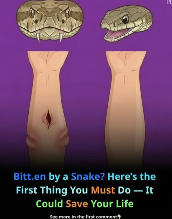 How to Handle a Snakebite: Essential First Aid Steps That Could Help