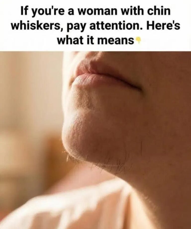 What Chin Hair in Women Really Says About Hormones