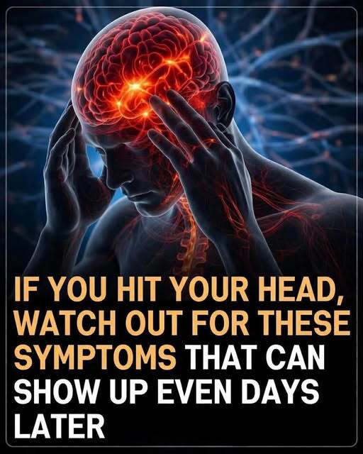 If you hit your head, watch out for these symptoms that can show up even days later